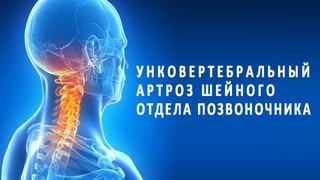 Унковертебральный (деформирующий) артроз шейного отдела позвоночника