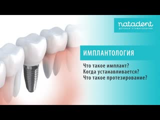 35. Что такое имплантация и протезирование зубов Натадент