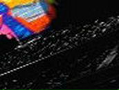 Анна Тюпина | Слободской