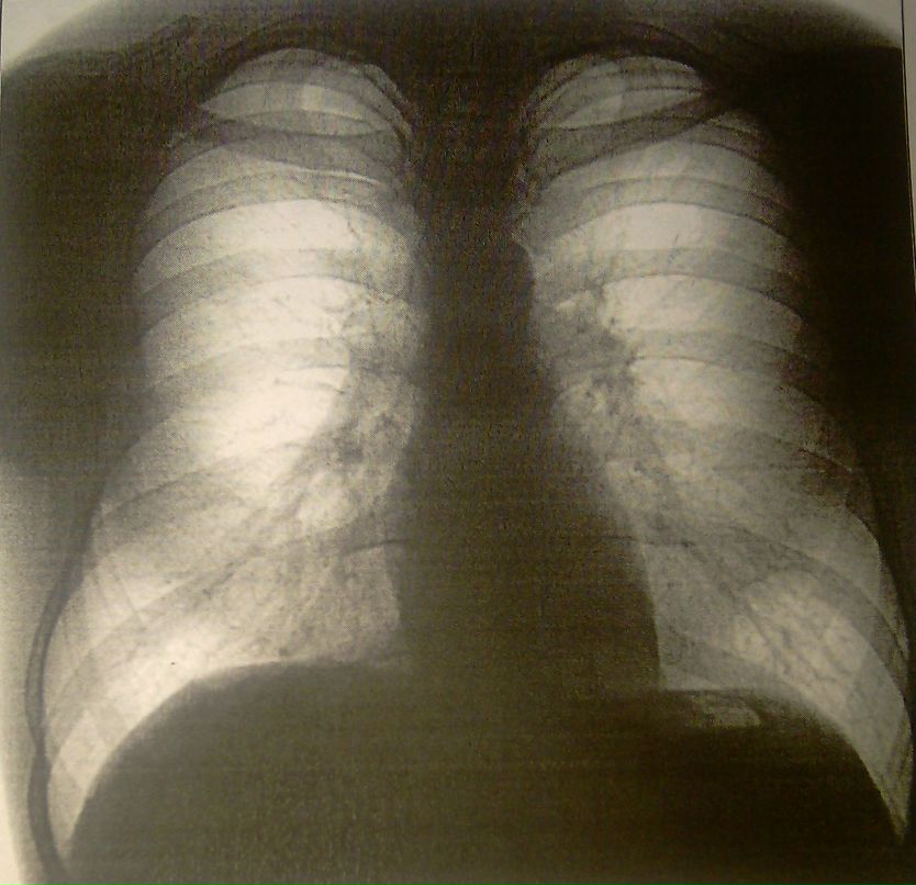 Илья Варламов | Ярославль