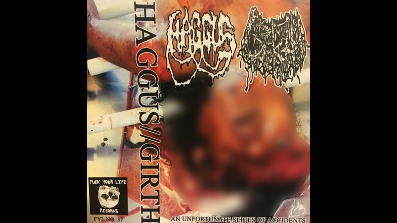 Girth, Haggus An Unfortunate Series Of Accidents split tape